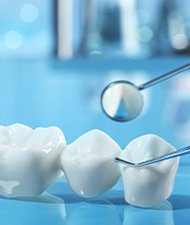 Dental bridges and dental implants are alternative types of tooth restorations